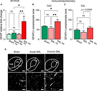 Impaired amygdala astrocytic signaling worsens neuropathic pain-associated neuronal functions and behaviors